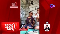 Dapat Alam Mo!: 31-anyos na lalaking may meningitis at epilepsy, patuloy na lumalaban sa buhay!