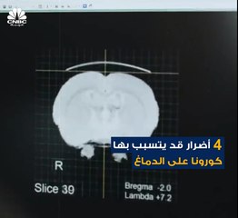 فيروس كورونا لا يضرب الجهاز التنفسي فقط، بل إنه قد يصيب الدماغ أيضاً