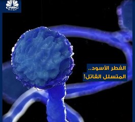 داء "الفطر الأسود" يرعب العالم.. ويتسبب في موت المصاب به خلال أيام