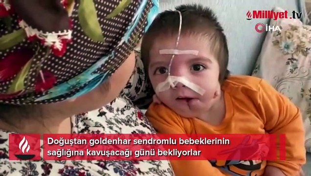 Nadir görülen 'Goldenhar Sendromu' ile dünyaya gelen Asım bebek, ameliyat olmayı bekliyor