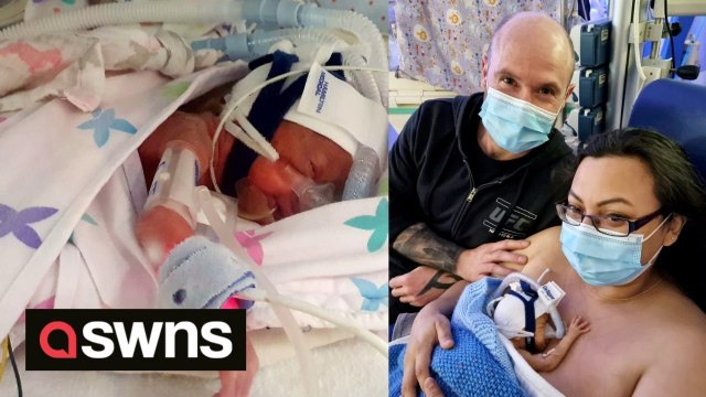 One of Britain's tiniest babies born at 1lb 4oz survived after being placed in a plastic BAG