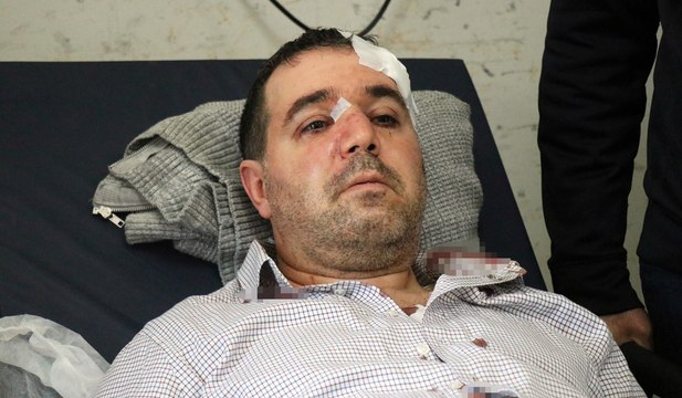 ‘Beni taciz, rahatsız ediyorsun’ diyerek aile hekiminin burnunu kırdı