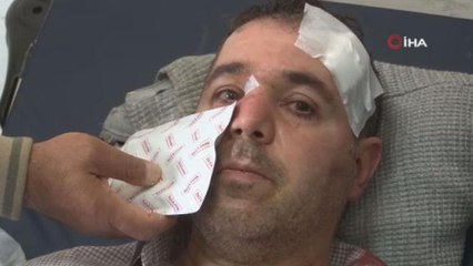 'Beni taciz, rahatsız ediyorsun' diyerek saldırdığı aile hekiminin burnunu kırdı