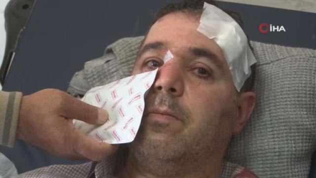 'Beni taciz, rahatsız ediyorsun' diyerek saldırdığı aile hekiminin burnunu kırdı