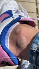 Julie Bertin se plaint d'une blessure à la cheville.
