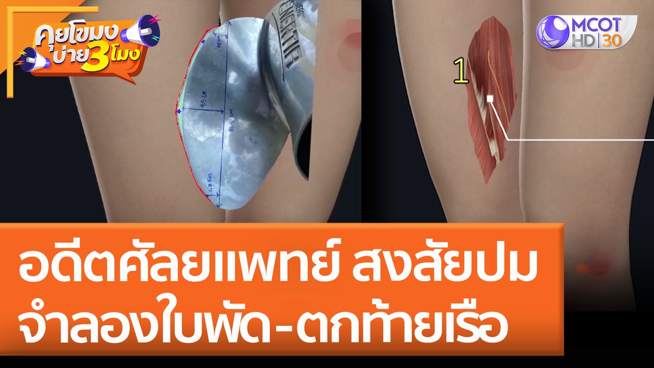 อดีตศัลยแพทย์ สงสัยปมจำลองใบพัด - ตกท้ายเรือ (2...
