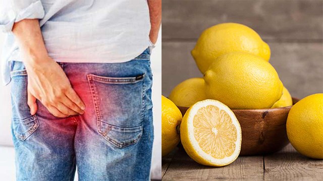 बवासीर का इलाज नींबू से हो सकता है क्या ? । Lemon can Cure Piles | Boldsky