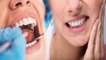 दांत उखाड़ने के नुकसान | दांत निकालने के नुकसान | Dant Nikalne Ke Nuksan | Boldsky