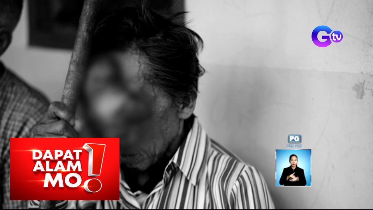 Dapat Alam Mo!: Mga bukol sa mukha, dulot umano ng masamang elemento!