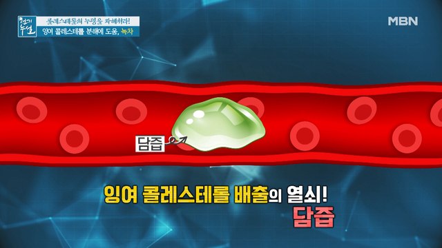 잉여 콜레스테롤 배출 돕는 생활 속 습관은?