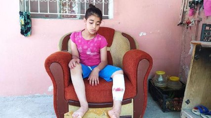 SOKAK KÖPEKLERİNİN SALDIRISINDA YARALANAN KARDELEN YAREN, TABURCU OLDU