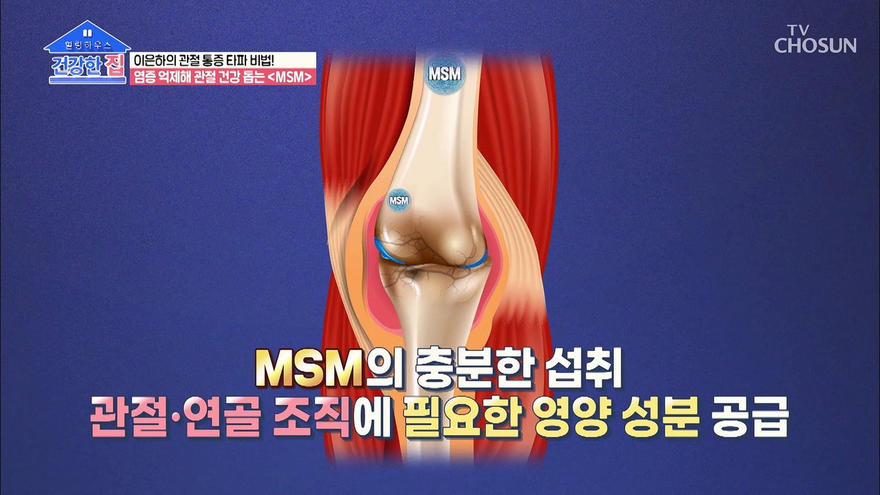 관절과 연골 건강에 도움을 주는 ‘천연 유기유황’ 『MSM』 TV CHOSUN 202...