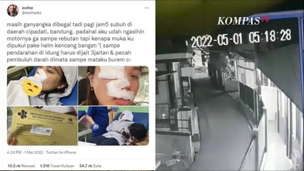 Nahas! Seorang Wanita Diserang Begal Hingga Alami Luka Parah di Bagian Wajah