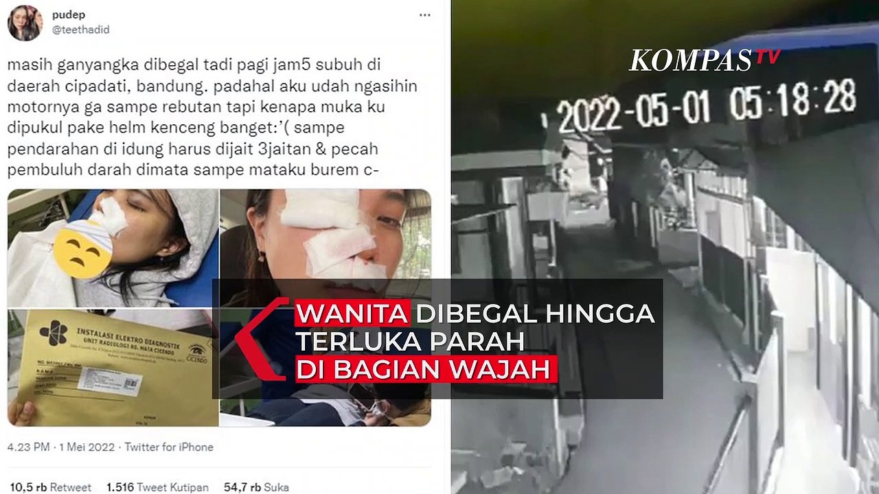 Nahas! Seorang Wanita Diserang Begal Hingga Alami Luka Parah di Bagian Wajah