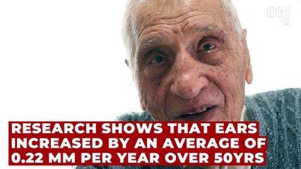 Big ears and nose: Study shows they do grow larger with age