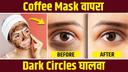 डार्क सर्कलमुळे हैराण आहात? करा हा उपाय | How to Get Rid of Dark Circles | Coffee Eye Mask |