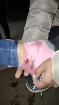 Fuerte cruce entre la policía y antimineros