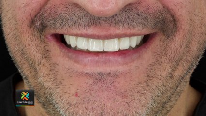 bd-en-que-consiste-el-diseño-de-sonrisa-040522