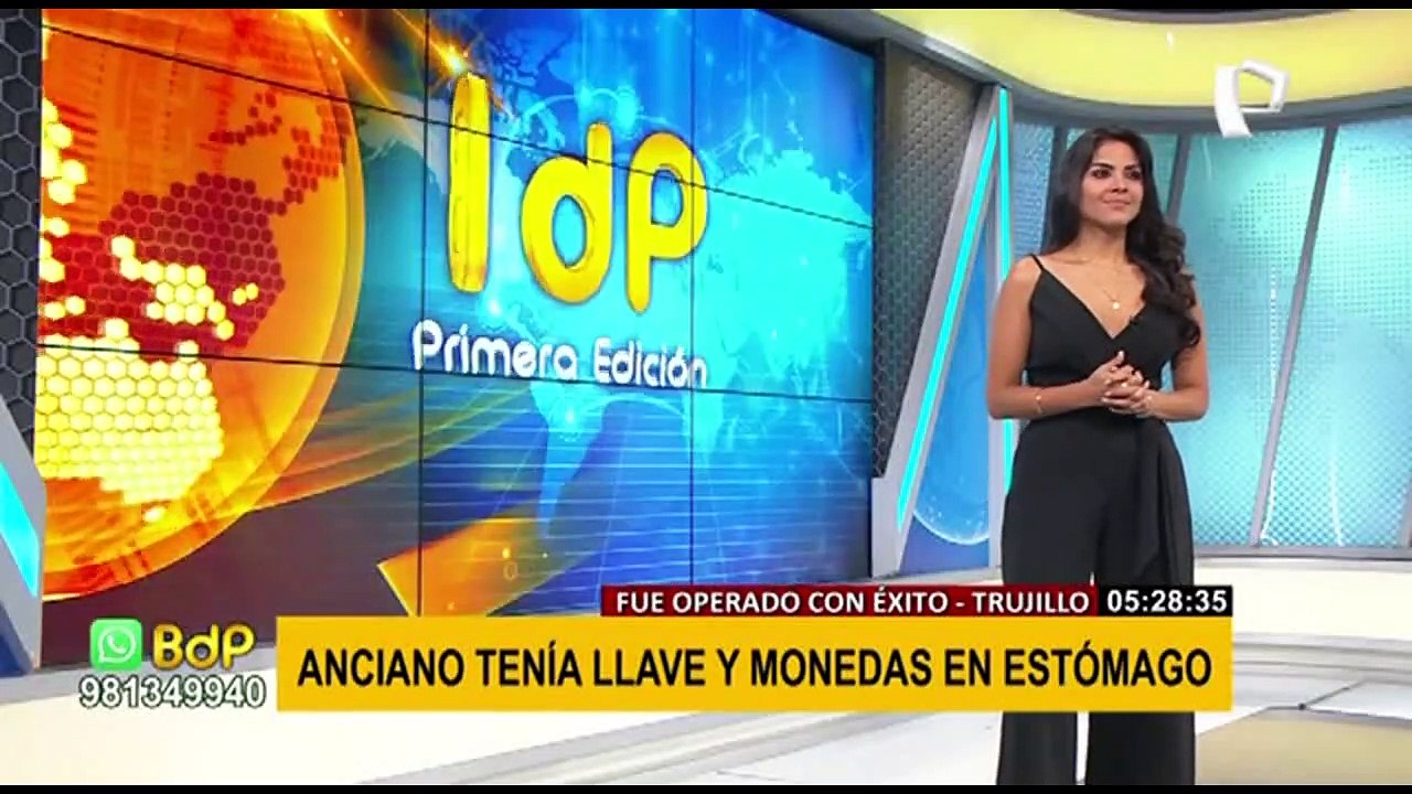 Trujillo: Operan con éxito a anciano que tenía una llave y monedas en el estomago