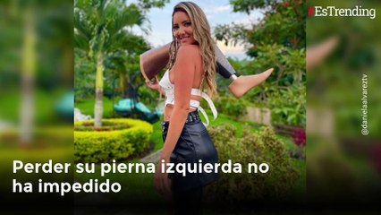 Así es la vida de la modelo colombiana Daniella Álvarez tras perder una pierna