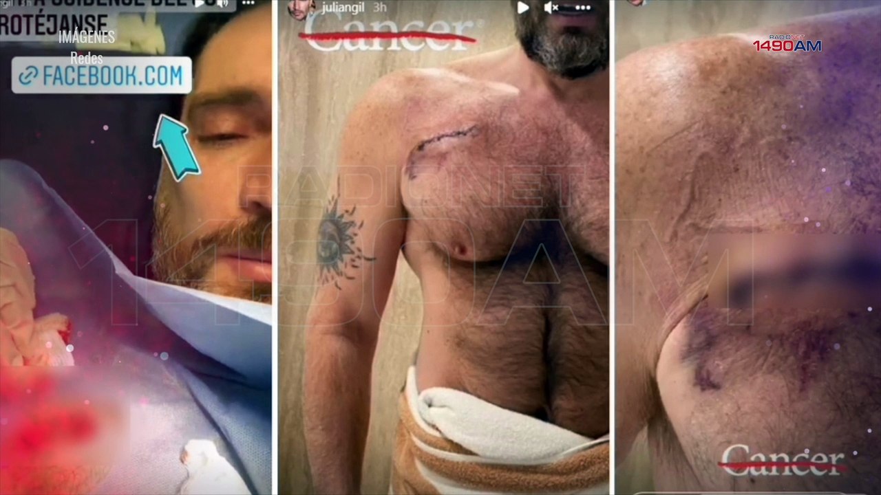 Julián Gil revela que fue diagnosticado con cáncer de piel
