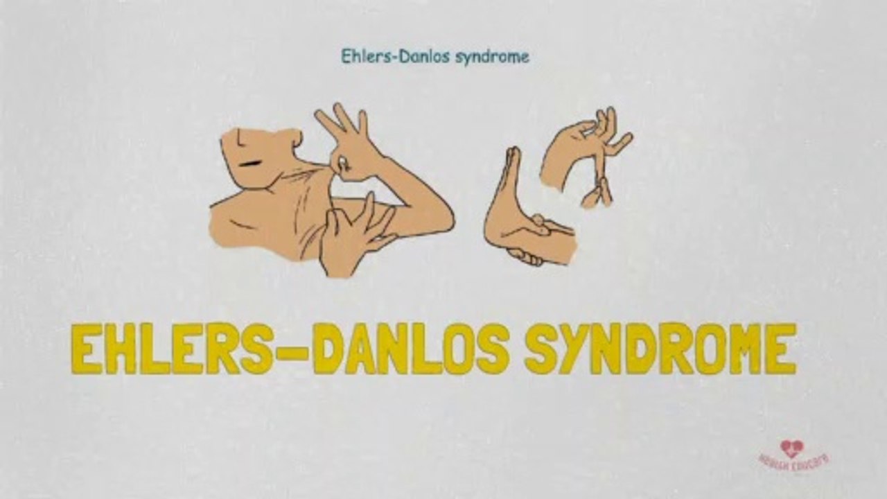 Ehlers-Danlos syndrome - Symptoms and causes