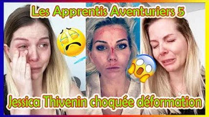 Les Apprentis Aventuriers 5  Le visage défiguré de Jessica Thivenin fuite, révélation choquante ❗️