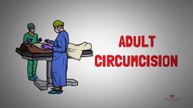 Adult Circumcision