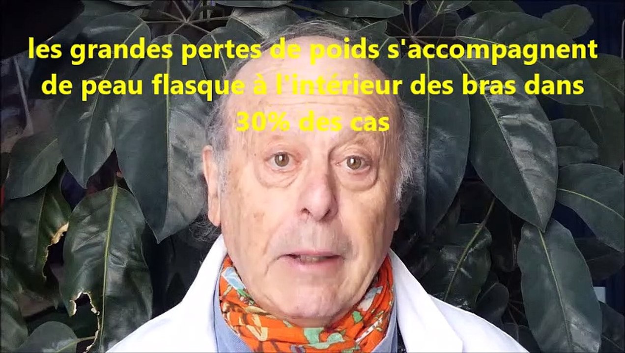 brachioplasties, explications par le dr Vladimir Mitz