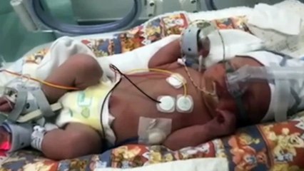 First-time mum caught Covid before giving birth and slipping into a COMA