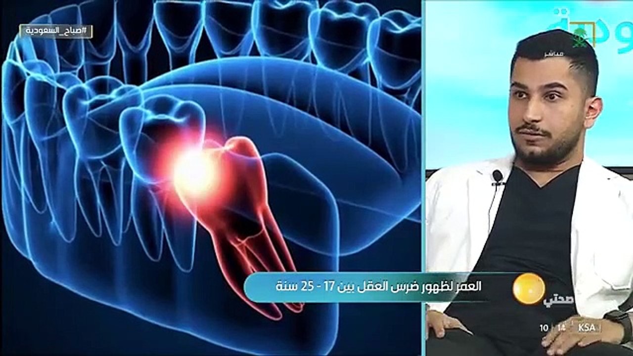 صباح_السعودية د. عبدالمجيد السياري الألم في الأذن والصداع من أعراض ظهور ضرس العقل. قناة_السعودية