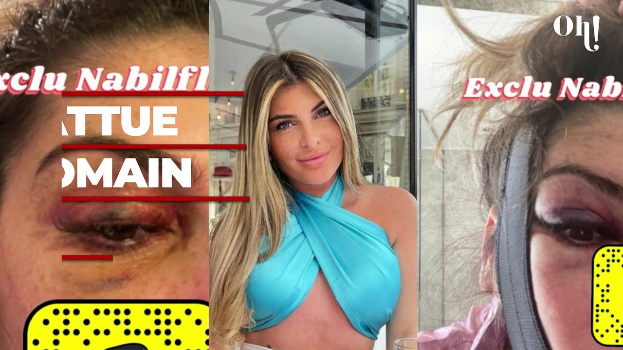 Melanight battue par son ex Romain Ben ? Les images choquantes font le tour des réseaux et indignent les internautes