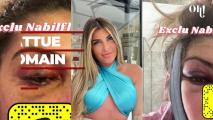 Melanight battue par son ex Romain Ben ? Les images choquantes font le tour des réseaux et indignent les internautes