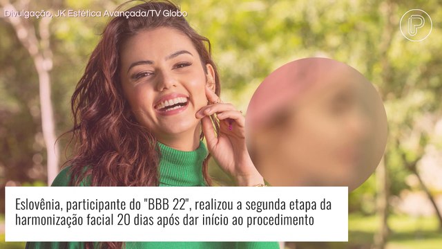 Eslovênia, do 'BBB 22', faz segunda etapa de harmonização facial e comenta mudanças: 'Inchada'. Veja antes e depois