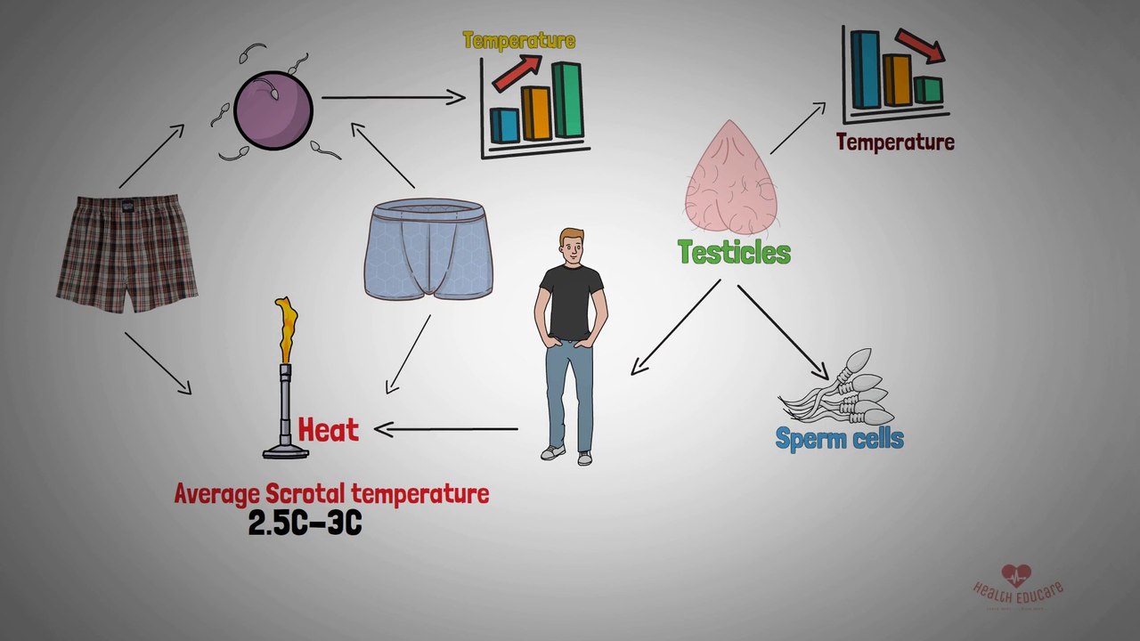 Do men's underwear matter for fertility? Briefs vs Boxers (Male