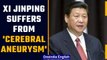Chinese President Xi Jinping is suffering from cerebral aneurysm, says media reports | Oneindia News