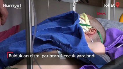 Buldukları cismi patlatan 4 çocuk yaralandı