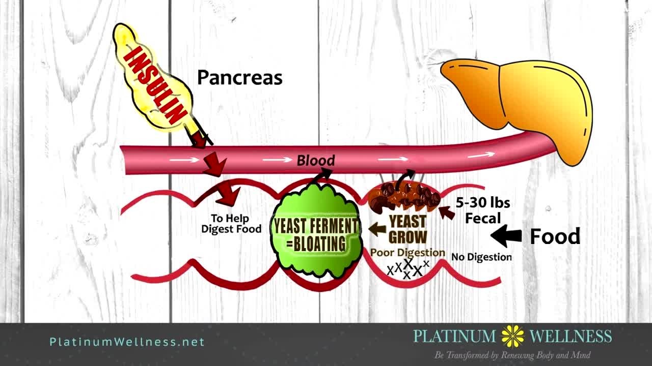 Platinum Wellness & Weight Loss: How to lower your A1C and lose some weight