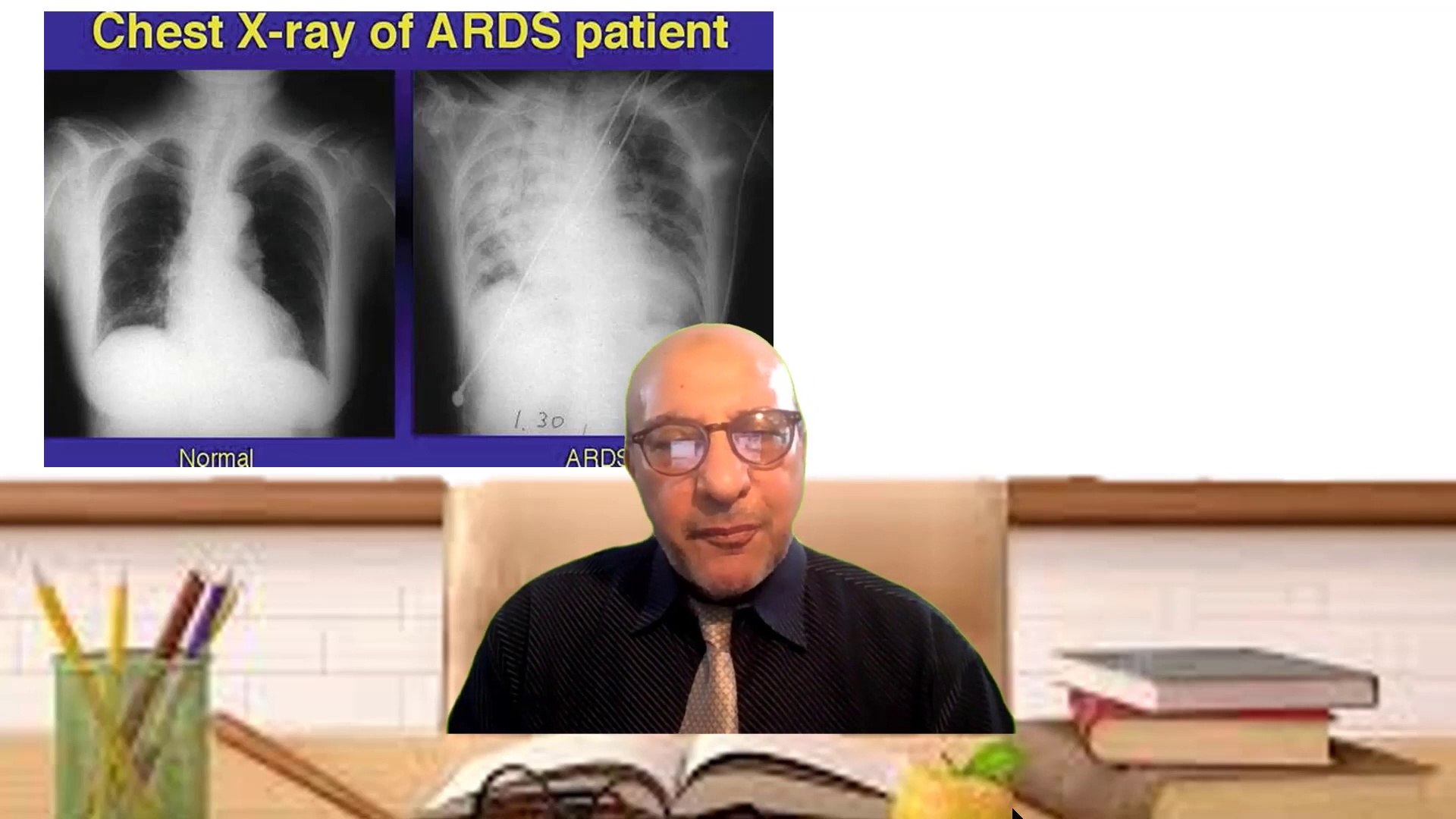 How to  diagnose causes of pulmonary edemaشرح بالعربى