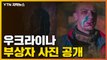 [자막뉴스] 최후 임박한 우크라이나...부상자 사진 공개 / YTN