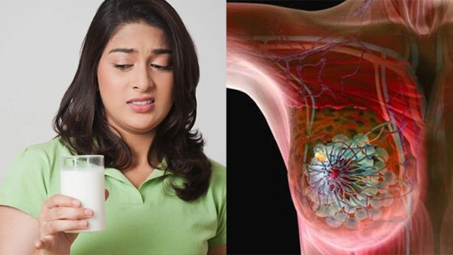 Milk और Dairy Products से Breast Cancer का खतरा | दूध से ब्रेस्ट कैंसर का खतरा कैसे | Boldsky