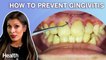 Periodontist Answers YOUR Questions About Bloody Gums, Gingivitis, and Checkups | Ask An Expert
