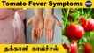 Kerala Tomato Fever | Tomato Fever Symptoms | Tomato Flu | Oneindia Tamil