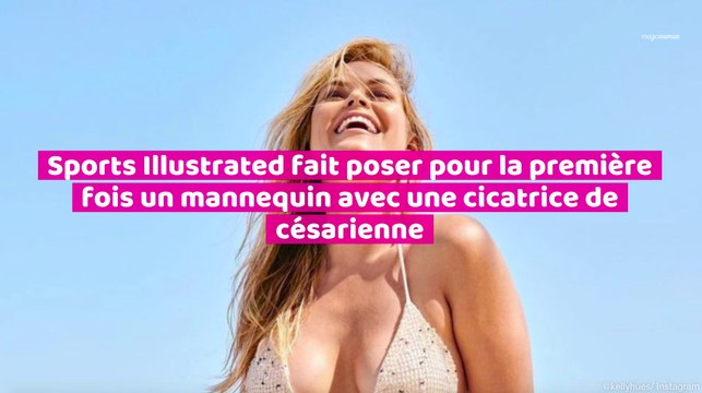 Sports Illustrated fait poser pour la première fois un mannequin avec une cicatrice de césarienne