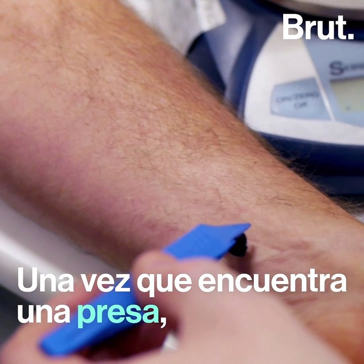 Las sanguijuelas, una herramienta valiosa en los hospitales