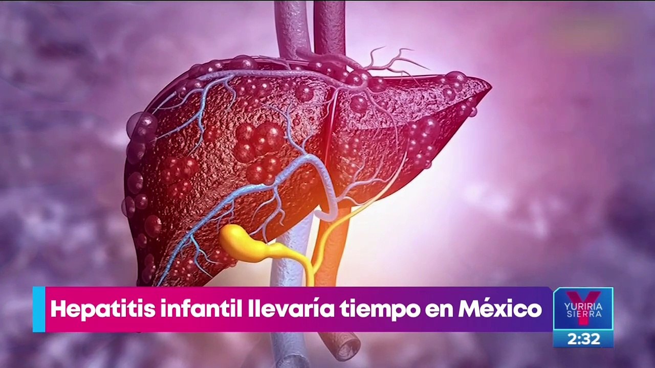 Hepatitis infantil aguda: ¿qué es y cuáles son los síntomas?