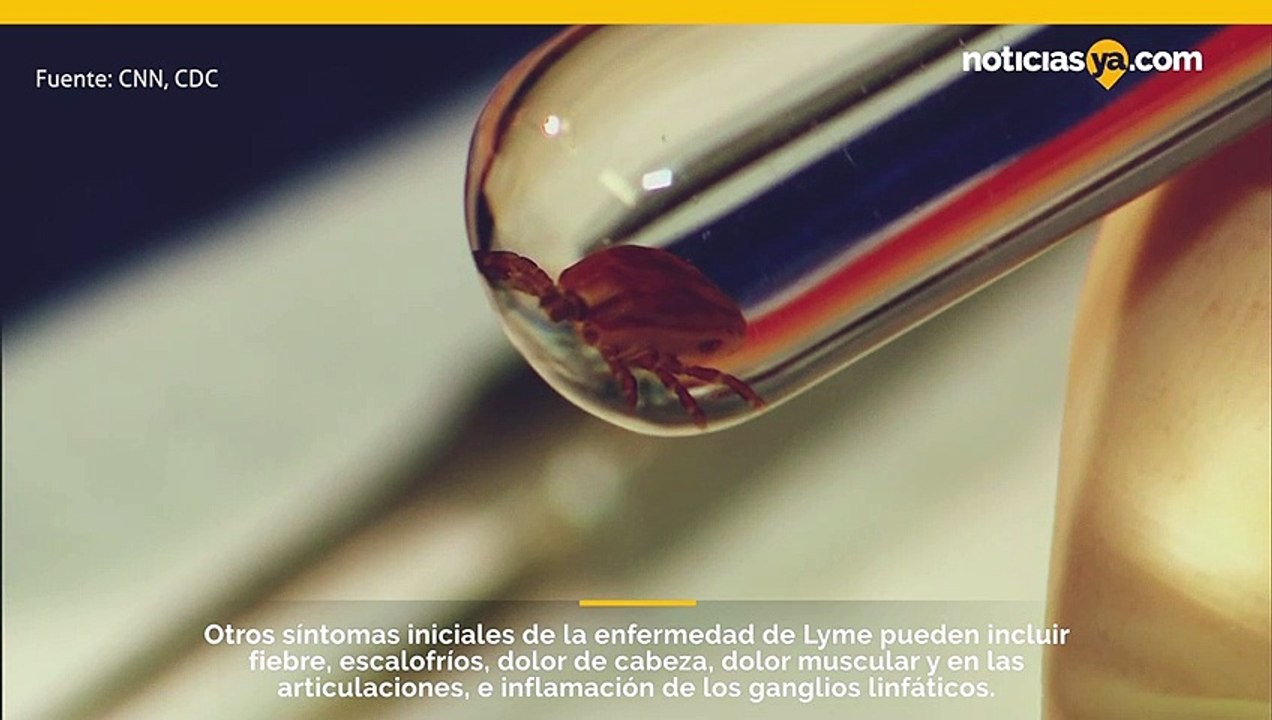El Minuto de Salud de hoy tiene más información sobre cómo prevenir enfermedades para el Mes Nacional de Concientización sobre Lyme.