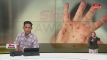 HFMD | Penutupan pusat jagaan kanak-kanak ditentukan PKPD