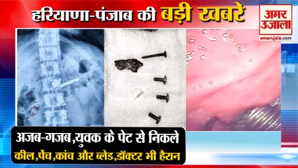 Doctor Found Blade Screws And Nail In Boy Stomach In Pgi Rohtak|रोहतक समेत हरियाणा की बड़ी खबरें