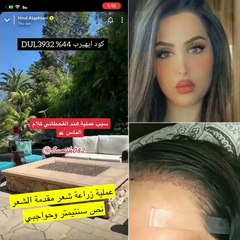 هند القحطاني تكشف سبب خضوعها لعملية جراحية